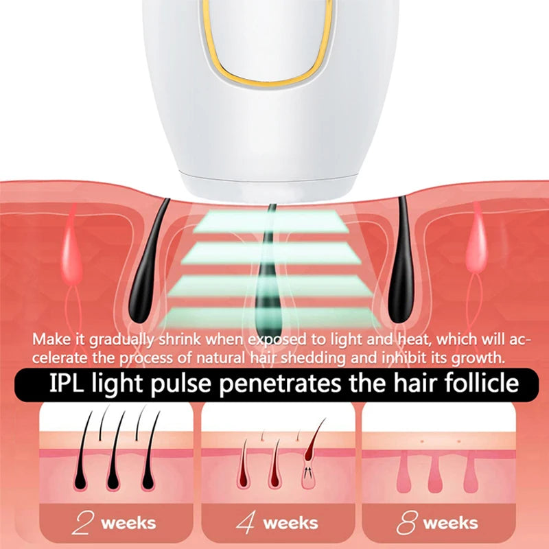 Depilador a laser permanente profissional IPL Portátil para Uso Doméstico